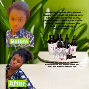 Magic hair growth oil by arcadiac_beauty